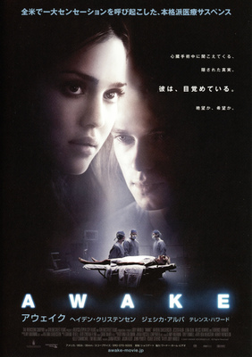 アウェイク