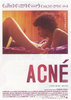 アクネ　ACNE